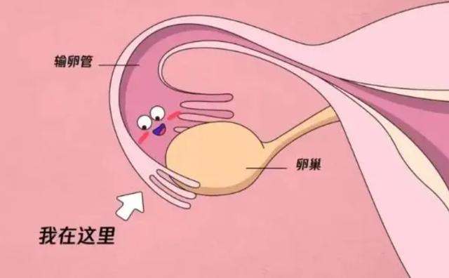 代孕