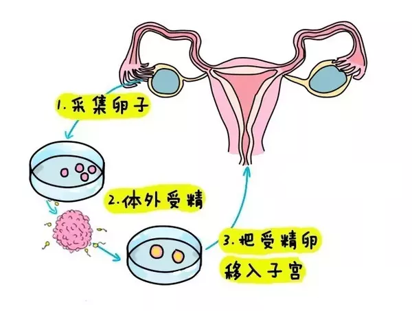 自我代孕