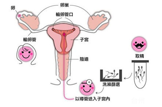 代孕新娘
