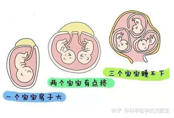人工流产
