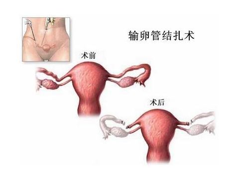 怀孕